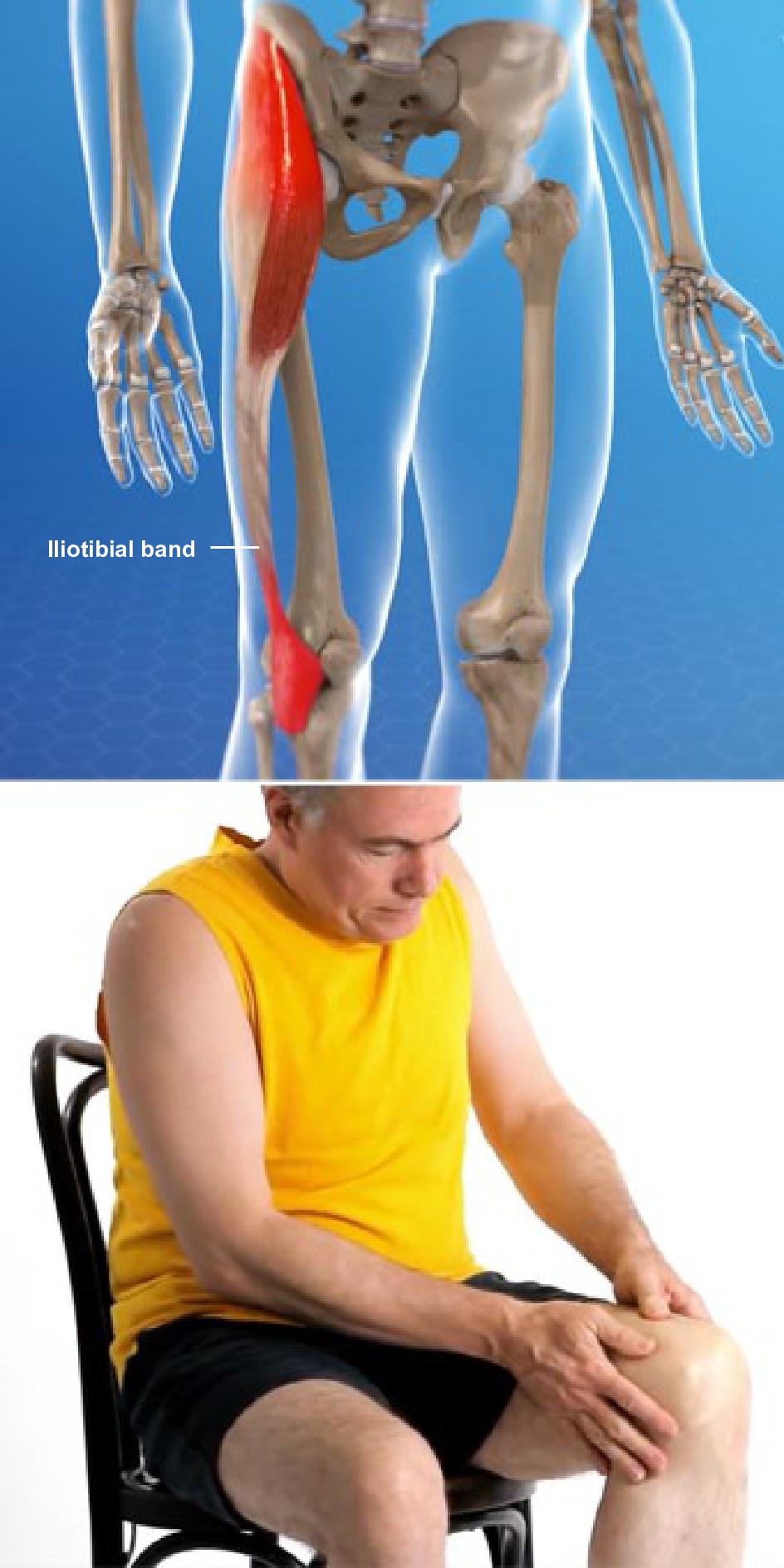 Hip Pain and Iliotibial Band Syndrome