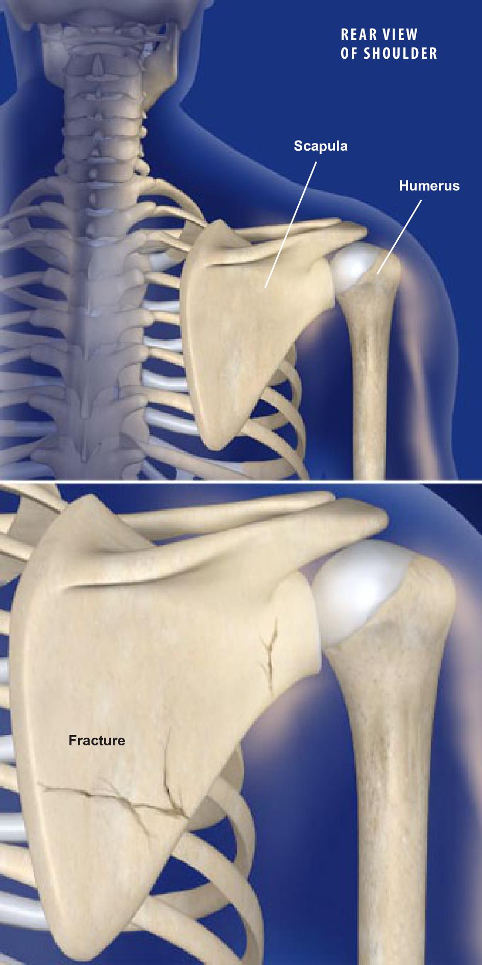 Best Shoulder Anatomy Images Shoulder Anatomy Anatomy Scapula | My XXX ...