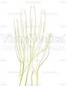 Hand, nervous system (palmar view, raised)