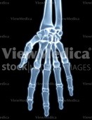 Hand (skeletal, palmar view, x-ray)