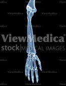 Hand and forearm (skeletal, pronation, dorsal view, x-ray)