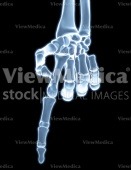 Hand, index finger pointing (skeletal, palmar view, x-ray)